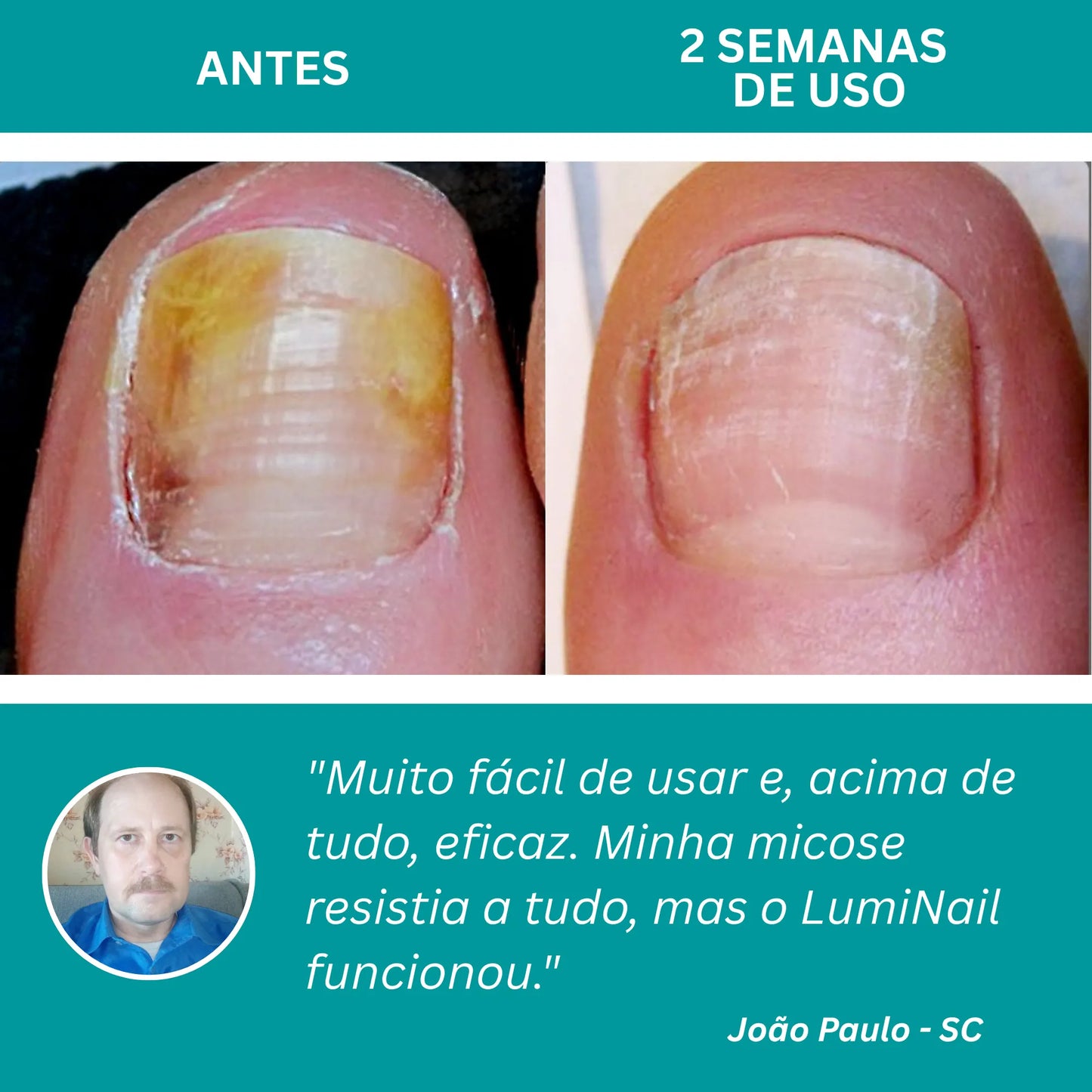 LumiNail Pro