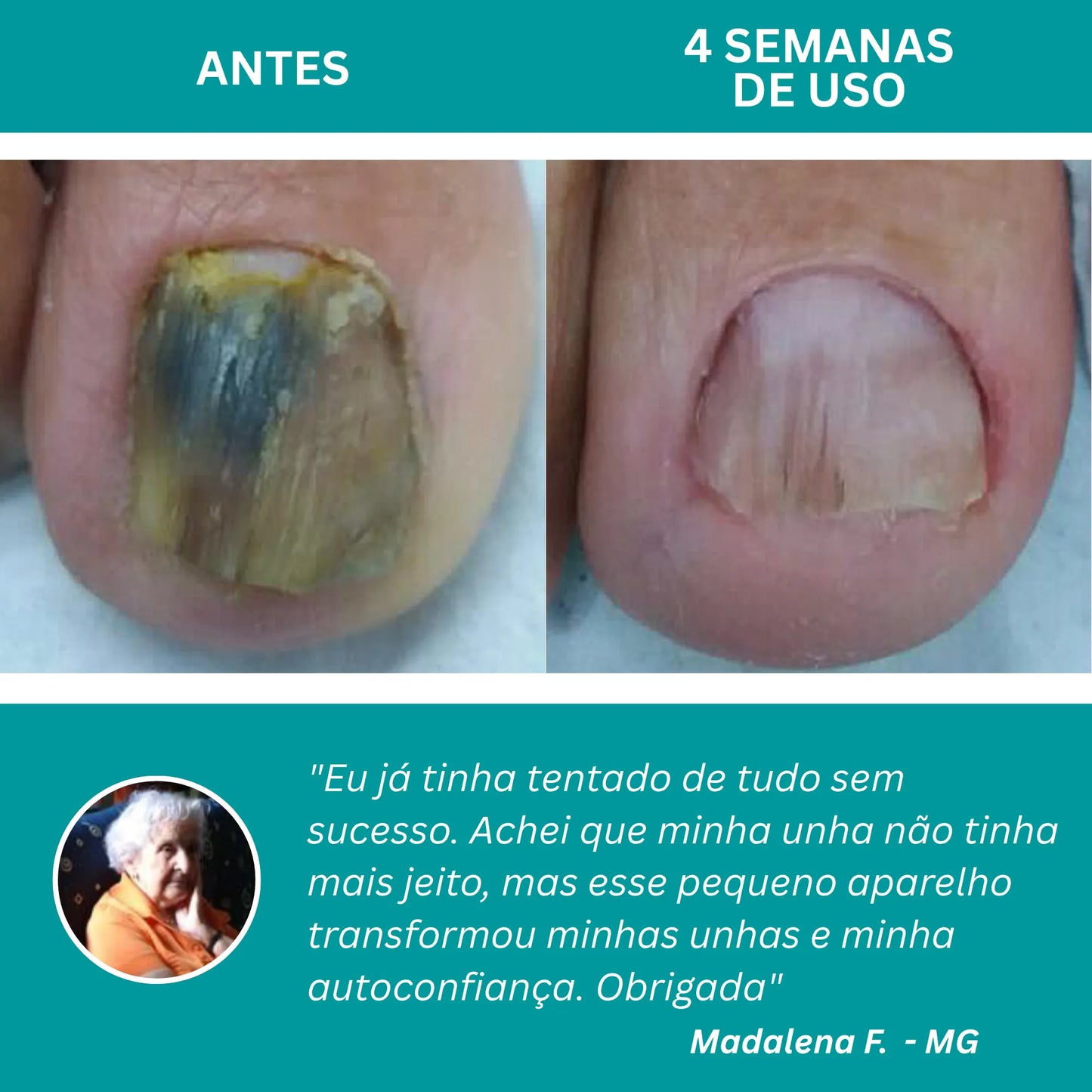 LumiNail Pro