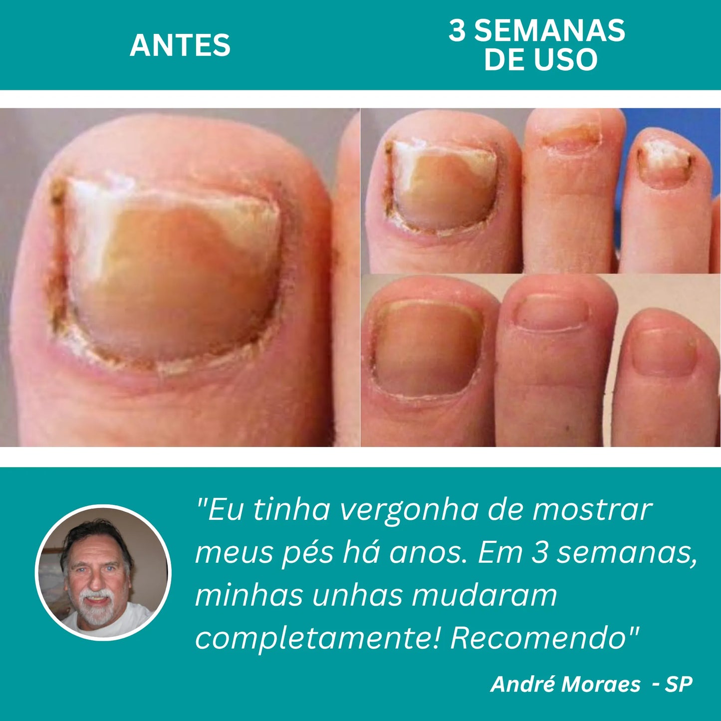 LumiNail Pro
