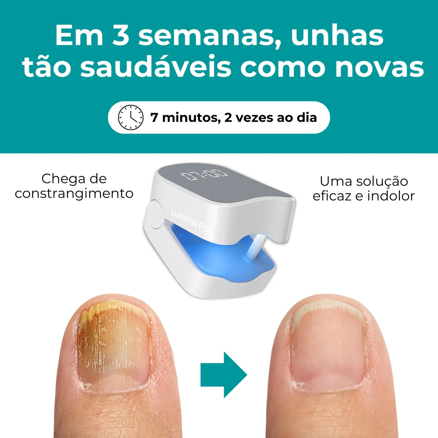 LumiNail Pro