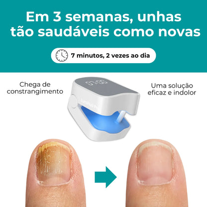 LumiNail Pro