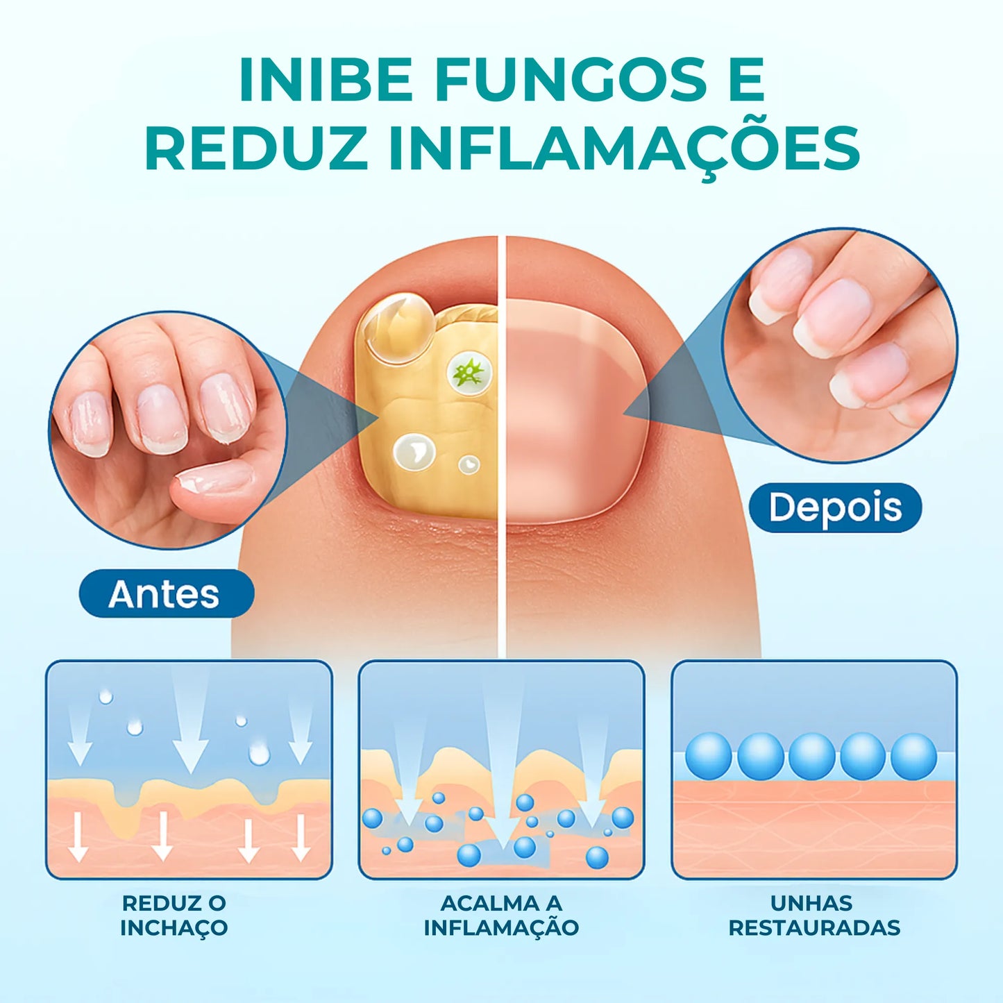 UngiGel - Adesivos para fungos