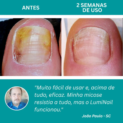 LumiNail Pro