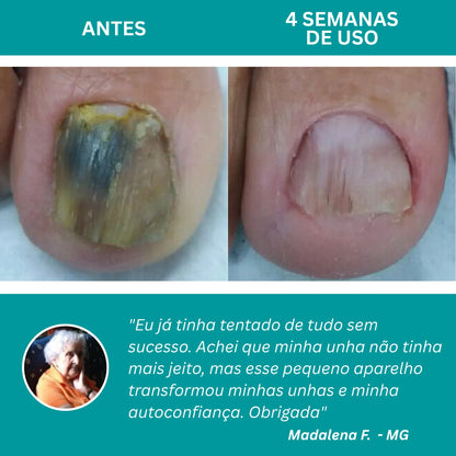 LumiNail Pro