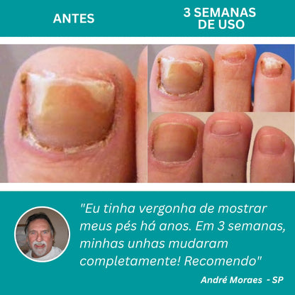 LumiNail Pro