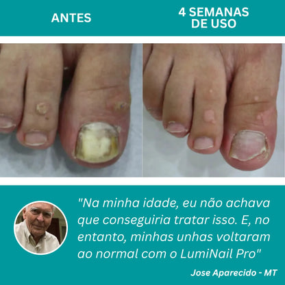 LumiNail Pro