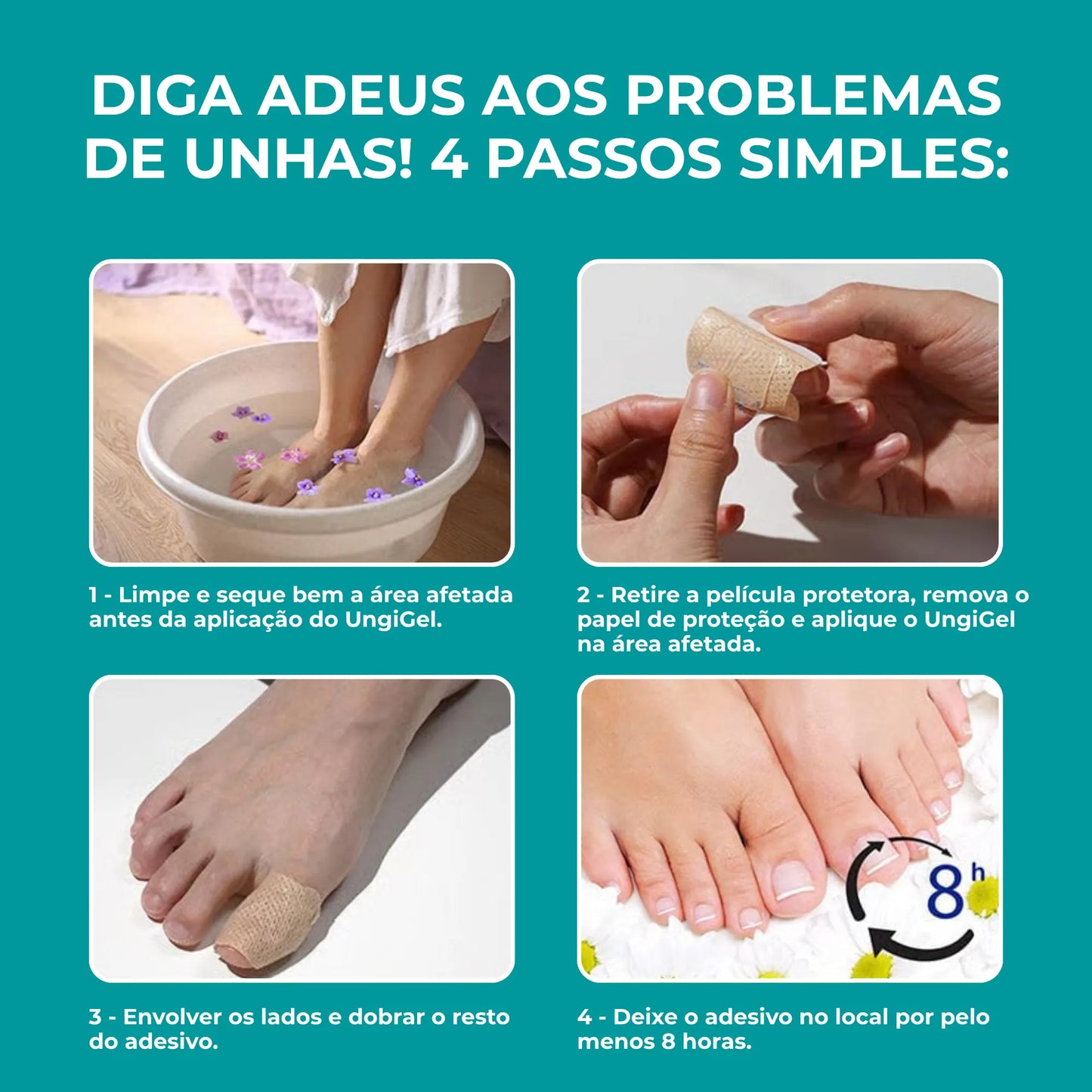 UngiGel - Adesivos para fungos